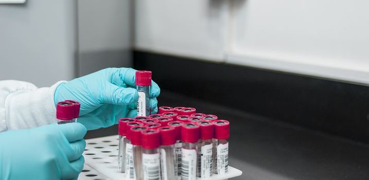 BioNTech Richtfest für neue Produktionsstätte in Mainz Hechtsheim