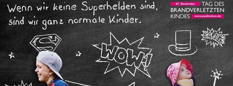 Heute ist Tag des brandverletzten Kindes: „Advent, Advent – es brennt!“