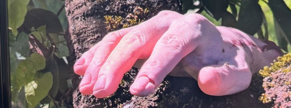 Scheinbar abgetrennte Hand sorgt für Polizeieinsatz in Ingelheim