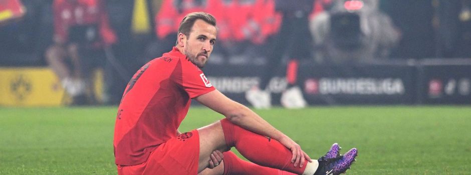 Druck und Zweifel: Kompany bastelt am Pokalteam ohne Kane