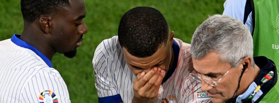 Frankreich und die Folgen von Mbappés Nasenbeinbruch