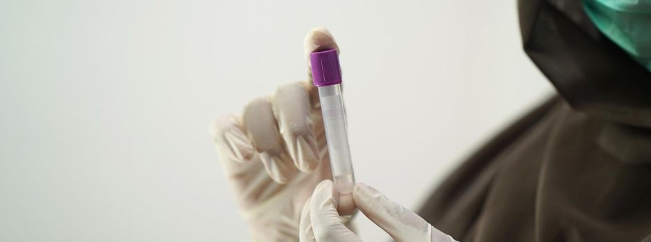 Erster Affenpocken-Fall in Hessen bestätigt