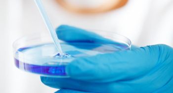 Heiliges Wasser löst Cholera-Fälle in Bad Kreuznach aus