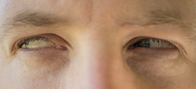 Wieso bist du schon geimpft? – Packt uns jetzt alle der Impfneid?