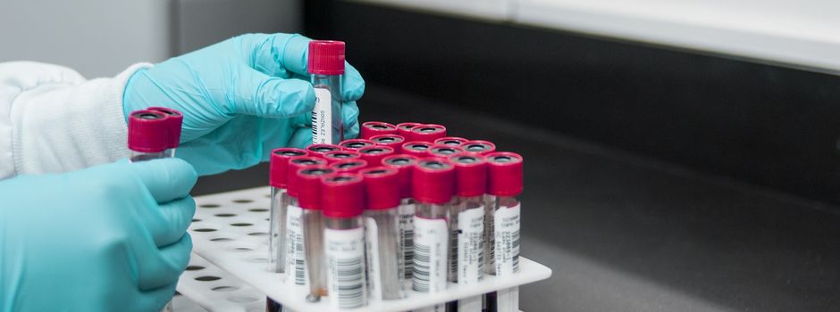 Wiesbaden auf mögliche Affenpocken-Fälle vorbereitet