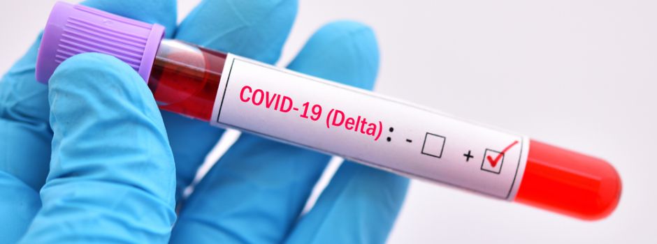 Trotz Delta-Variante massive Lockerungen: Ist das nicht zu gefährlich?