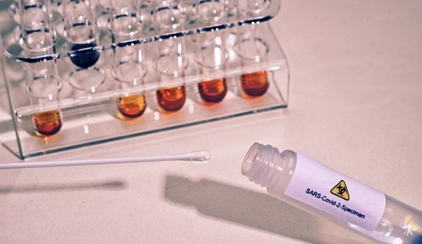 Verdacht auf Corona: Wer bekommt einen kostenlosen PCR-Test?