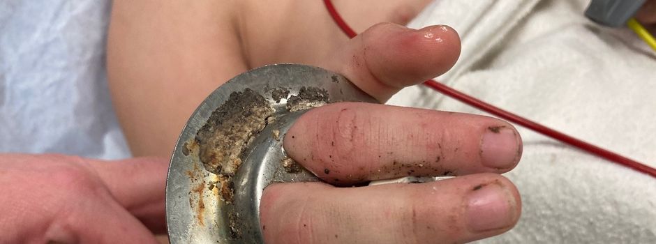 Drama um Kleinkind: Wiesbadener Feuerwehr mit kompliziertem Einsatz