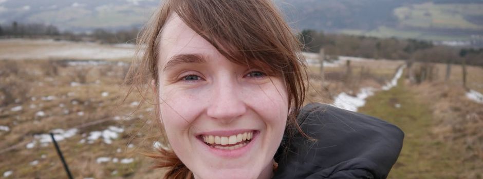 „Froh, dass ich noch lebe“: Diese Mainzerin lebt mit der „Wolfskrankheit“
